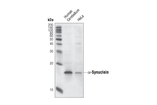 Western blot analysis of extracts from human cerebellum and HeLa cells, using α-Synuclein (Syn204) Mouse mAb.