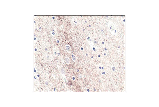 Immunohistochemical analysis of paraffin-embedded human brain, using α-Synuclein (Syn204) Mouse mAb.