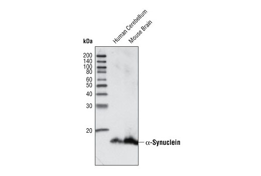 Western blot analysis of extracts from human cerebellum and mouse brain using α-Synuclein (IF Preferred) Antibody.