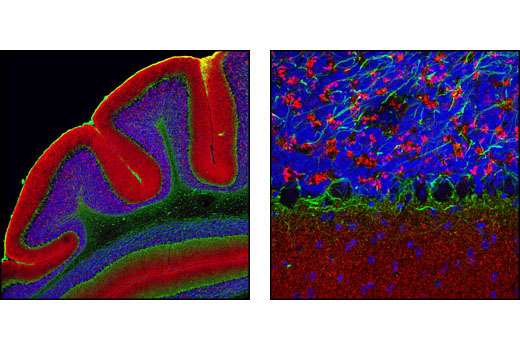 Confocal immnofluorescent analysis of mouse brain using α-Synuclein Antibody (IF Preferred) (red) and Neurofilament-L (DA2) Mouse mAb #2835 (green). Blue pseudocolor = DRAQ5 ® #4084 (fluorescent DNA dye).