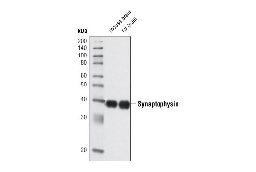 Western blot analysis of extracts from mouse and rat brain using Synaptophysin (D35E4) Rabbit mAb.