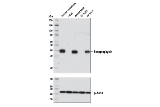 Western blot analysis of extracts from various tissues and cell lines using Synaptophysin (7H12) Mouse mAb (upper) or β-Actin (D6A8) Rabbit mAb #8457 (lower).