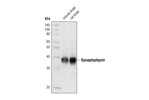 Western blot analysis of extracts from mouse and rat brain using Synaptophysin (D40C4) Rabbit mAb.