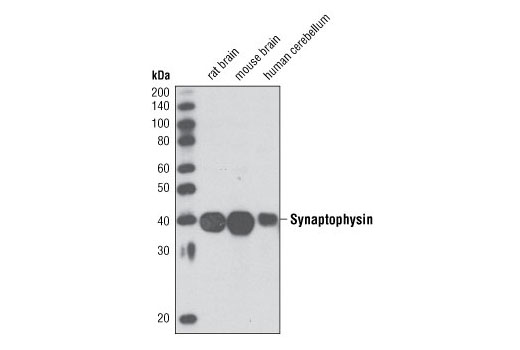 Western blot analysis of extracts from rat brain, mouse brain and human cerebellum using Synaptophysin Antibody.