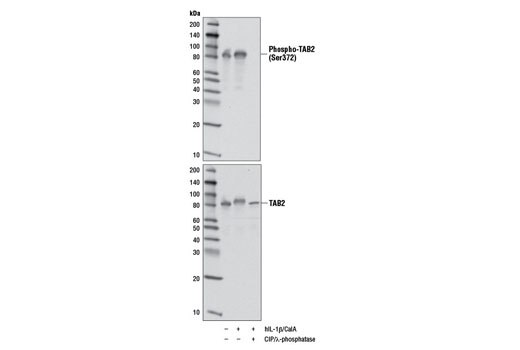 Western blot analysis of extracts from 293T cells, untreated or treated with Human Interleukin-1β (hIL-1β) #8900 (50 ng/ml) and Calyculin A (Serine/Threonine Phosphatase Inhibitor) #9902 (CalA) (100 nM, 20 min), using Phospho-TAB2 (Ser372) (D5A4) Rabbit mAb (upper) or total TAB2 (C88H10) Rabbit mAb #3745 (lower). Lysates were then treated with a combination of calf intestinal phosphatase (CIP) and λ-phosphatase to show phospho-specificity.