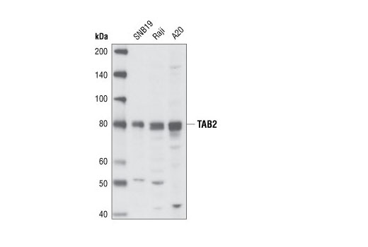 Western blot analysis of extracts SNB19, Raji and A20 cell lines using TAB2 Antibody.