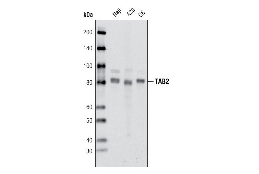 Western blot analysis of extracts from Raji, A20 and C6 cell lines using TAB2 (C88H10) Rabbit mAb.