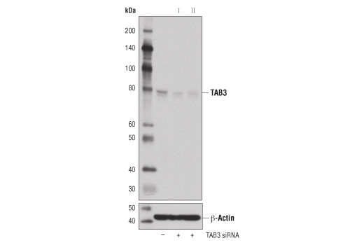 Western blot analysis of extracts from 293T cells, transfected with 100 nM SignalSilence ® Control siRNA (Unconjugated) #6568, SignalSilence ® TAB3 siRNA I #14212, or SignalSilence ® TAB3 siRNA II #14225, using TAB3 (D5J7D) Rabbit mAb (upper) or β-Actin (D6A8) Rabbit mAb #8457 (lower). The TAB3 (D5J7D) Rabbit mAb confirms silencing of TAB3 expression, while the β-Actin (D6A8) Rabbit mAb is used as a loading control.