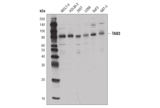 Western blot analysis of extracts from various cell lines using TAB3 (D5J7D) Rabbit mAb.