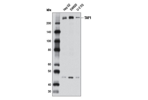 Western blot analysis of extracts from Hep G2, SW620 and U-2 OS cells using TAF1 (D6J8B) Rabbit mAb.