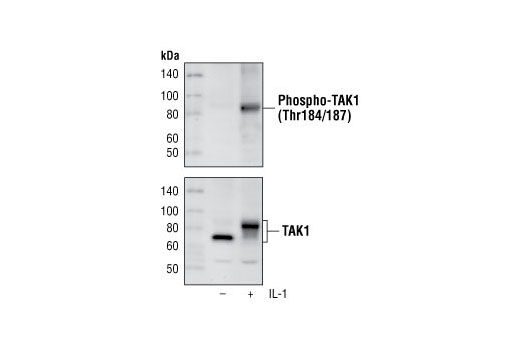 Western blot analysis of extracts from 293 IL-1R cells, untreated or treated for 10 minutes with IL-1, using Phospho-TAK1 (Thr184/187) (90C7) Rabbit mAb (upper) or TAK1 Antibody #4505 (lower).