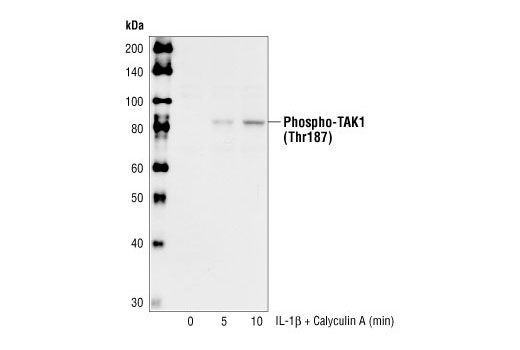 Western blot analysis of extracts from 293IL-1R cells, untreated or treated with IL-1beta and Calyculin A for the indicated times, using Phospho-TAK1 (Thr187) Antibody.