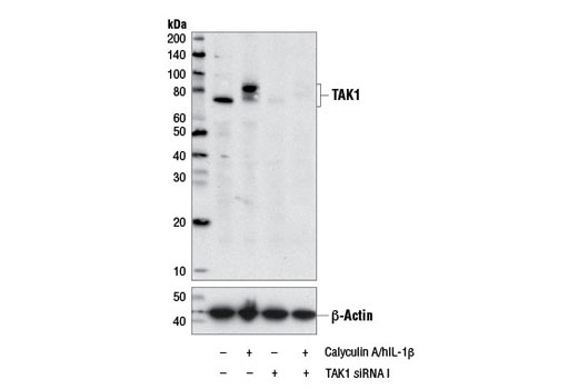 Western blot analysis of extracts from HeLa cells co-treated with and without 100nM Calyculin A (#9902) and 20 ng/mL hIL-1β (#8900) for 10 min., and transfected with and without 100nM SignalSilence ® TAK1 siRNA I (#6317) using Phospho-TAK1 (Ser412) Antibody #9339 (top) and β-actin (13E5) Rabbit mAb #4970 (bottom).