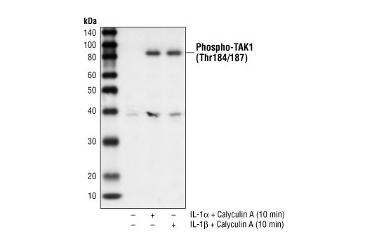 Western blot analysis of extracts from 293 IL-1R cells treated with IL-1alpha (20 ng/ml) or IL-1beta (10 ng/ml) and Calyculin A (50 nM) for 10 minutes, using Phospho-TAK1 (Thr184/187) Antibody.