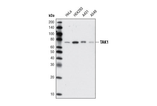 Western blot analysis of extracts from various cell lines using TAK1 (D94D7) Rabbit mAb.