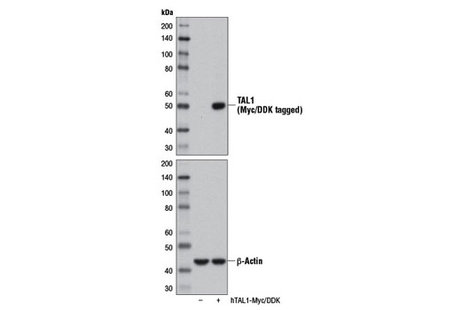 Western blot analysis of 293 cell extracts, mock transfected (-) or transfected with a construct expressing Myc/DDK-tagged full-length human TAL1 (hTAL1-Myc/DDK; +), using TAL1 Antibody (upper) or β-Actin (D6A8) Rabbit mAb #8457 (lower).