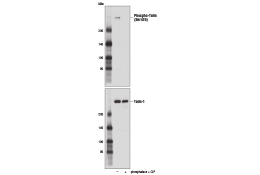 Western blot analysis of extracts from 293T cells, untreated (-) or treated with λ phosphatase and calf intestinal phosphatase (CIP; +), using Phospho-Talin (Ser425) (D2P2M) Rabbit mAb (upper) and Talin-1 (C45F1) Rabbit mAb #4021 (lower).
