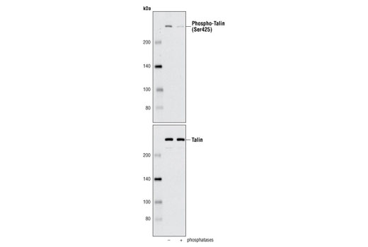 Western blot analysis of extracts from 293T cells, untreated or treated with λ and calf intestinal phosphatases using Phospho-Talin (Ser425) Antibody (upper) or Talin-1 (C45F1) Rabbit mAb #4021 (lower).