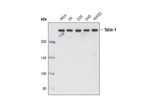 Western blot analysis of extracts from various cell types using Talin-1 (C45F1) Rabbit mAb.