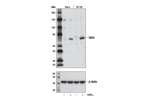 Western blot analysis of extracts from HeLa and HT-29 cells, untreated (-) or treated with Human Interferon-γ (hIFN-γ) #8901 (10 ng/ml, 16 hr; +), using TAP2 Antibody (upper) or β-Actin (D6A8) Rabbit mAb #8457 (lower).