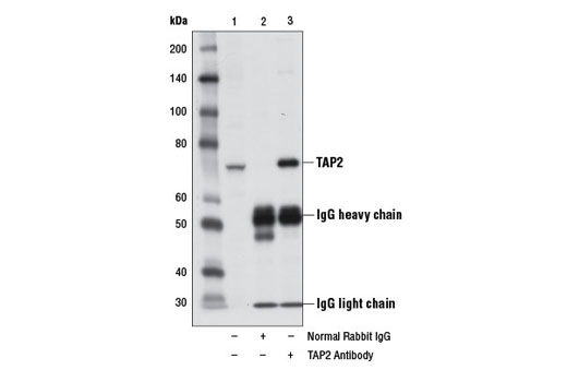Immunoprecipitation of TAP2 from HeLa cell extracts treated with Human Interferon-γ (hIFN-γ) #8901 (10 ng/ml, 16 hr), using Normal Rabbit IgG #2729 (lane 2) or TAP2 Antibody (lane 3). Lane 1 is 10% input. Western blot analysis was performed using TAP2 Antibody.