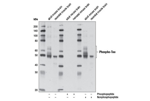 Western blot analysis of extracts from adult and neonatal mouse brain using Phospho-Tau (Ser202) Antibody. The phospho-specificity of the antibody was verified by blocking with a phospho or nonphosphopeptide.