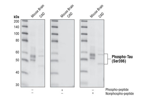 Western blot analysis of extracts from mouse brain and CAD cells, using Phospho-Tau (Ser396) (PHF13) Mouse mAb. The phospho-specificity of the antibody was verified by peptide blocking using no peptide, phospho-peptide or nonphospho-peptide.