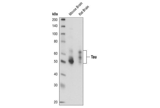 Western blot analysis of extracts from mouse and rat brain, using Tau (Tau46) Mouse mAb.