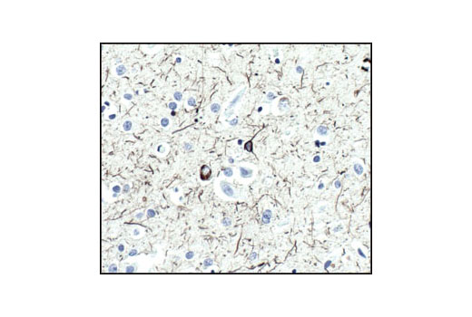 Immunohistochemical analysis of paraffin-embedded Alzheimer's brain, using Tau (Tau46) Mouse mAb.