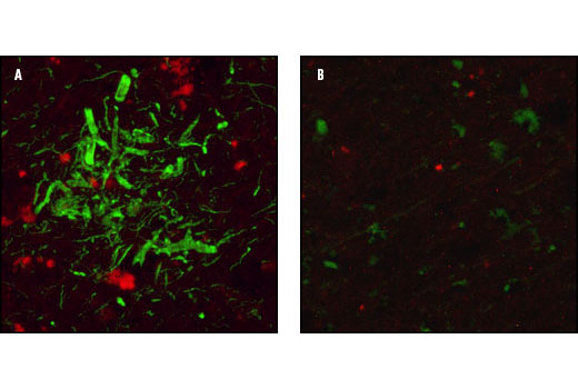 Confocal immunofluorescent analysis of human Alzheimer brain (A) labeled with Tau (Tau46) Mouse mAb (green) and APP Antibody #2452 (red) compared to normal human brain (B).