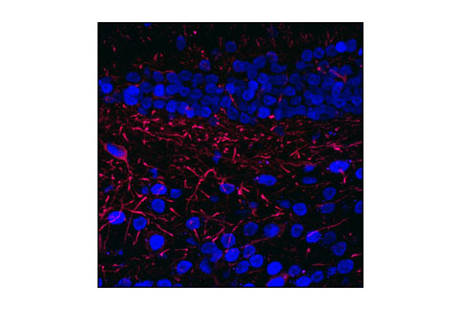 Confocal immunofluorescent analysis of mouse dentate gyrus stained with Tau (Tau46) Mouse mAb (red) and CREB (86B10) Mouse mAb #9104 (blue).