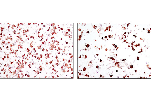 Immunohistochemical analysis of paraffin-embedded COS-7 cell pellets, transfected with YAP (left) or TAZ (right), using YAP/TAZ (D24E4) Rabbit mAb.