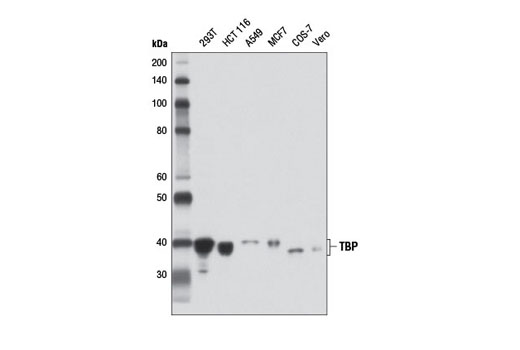 Western blot analysis of extracts from various cell lines using TBP (D5G7Y) Rabbit mAb.