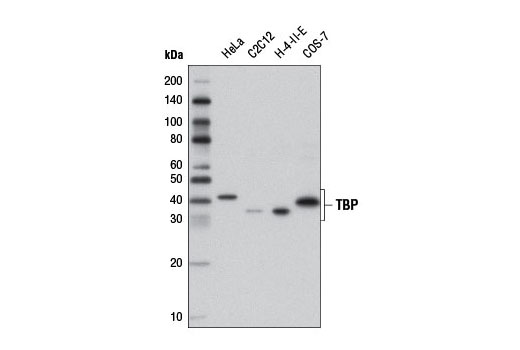 Western blot analysis of extracts from various cell lines using TBP Antibody.