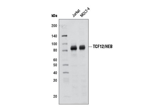Western blot analysis of extracts from Jurkat and MOLT-4 cells using TCF12/HEB (D2C10) Rabbit mAb.