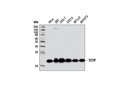 Western blot analysis of extracts from various cell lines using TCTP (D10F2) Rabbit mAb.