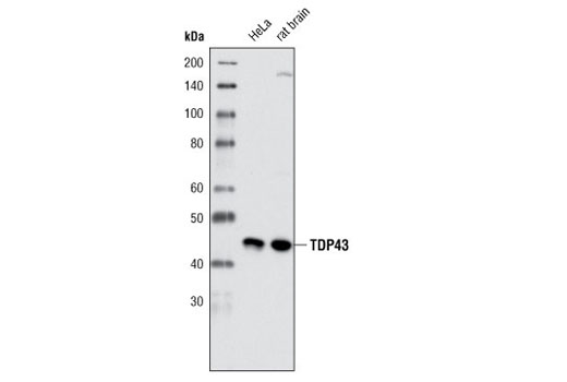 Western blot analysis of extracts from HeLa cells and rat brain using TDP43 (G400) Antibody.
