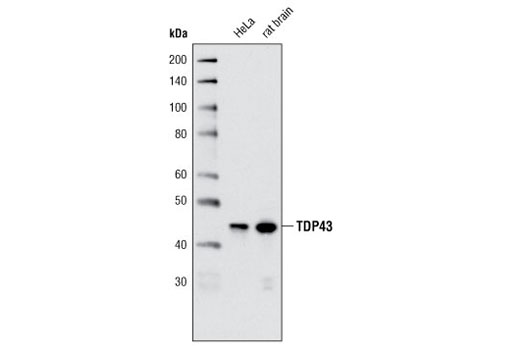 Western blot analysis of extracts from HeLa cells and rat brain using TDP43 (A260) Antibody.