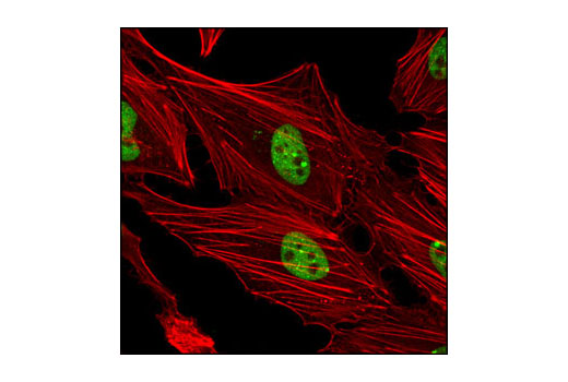 Confocal immunofluorescent analysis of HeLa cells using TDP43 (A260) Antibody (green). Actin filaments have been labeled with DY-554 phalloidin (red).