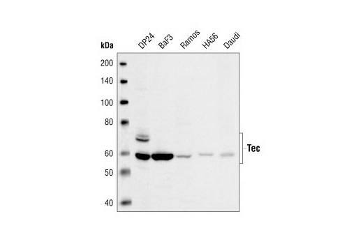 Western blot analysis of extracts from various cell lines, using Tec Antibody.