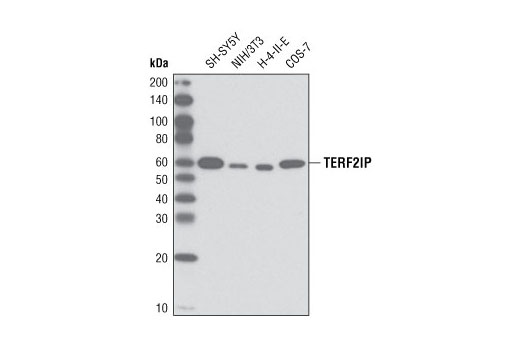 Western blot analysis of extracts from various cell lines using TERF2IP (D9H4) Rabbit mAb.