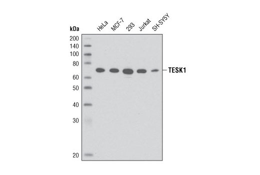 Western blot analysis of extracts from various cell types using TESK1 (D49D4) Rabbit mAb.