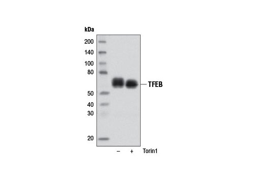 Western blot analysis of extracts from Raji cells, untreated (-) or Torin1-treated (250 nM, 1 hr; +), using TFEB Antibody.
