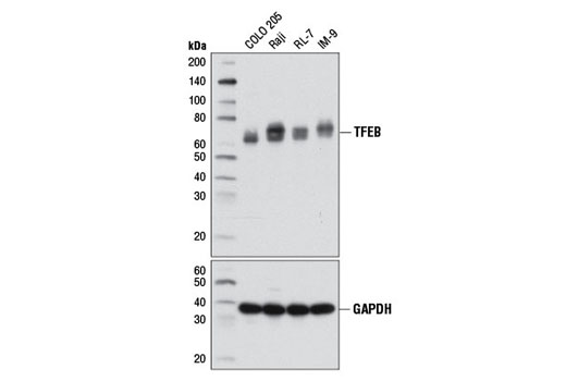 Western blot analysis of extracts from various cell lines using TFEB Antibody (upper) or GAPDH (D16H11) XP ® Rabbit mAb #5174 (lower).