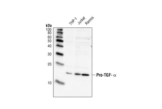 Western blot analysis of extracts from THP-1, Jurkat, and Ramos cells, using Pro-TGF-alpha Antibody.