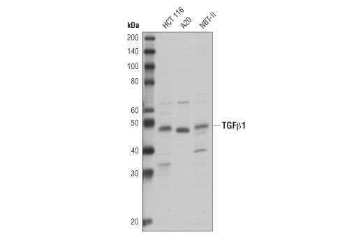 Western blot analysis of extracts from HCT 116, A20, and NBT-II cells using TGF-beta Antibody.