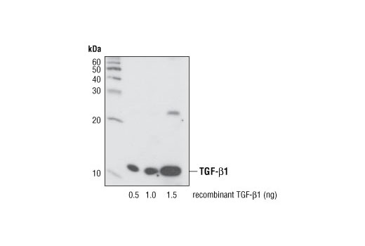 Western blot analysis of recombinant active TGF-β1 using TGF-β (56E4) Rabbit mAb.