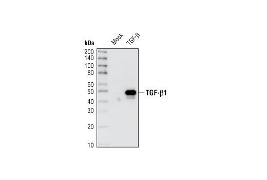 Western blot analysis of extracts of HeLa cells, mock transfected or transfected with TGF-β1 precursor, using TGF-β (56E4) Rabbit mAb.