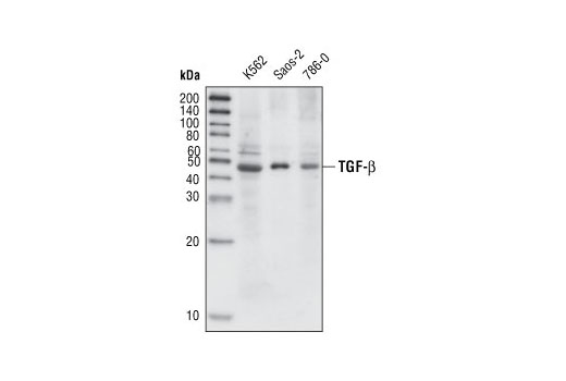Western blot analysis of extracts from K-562, Saos-2 and 786-0 cells using TGF-β (56E4) Rabbit mAb.