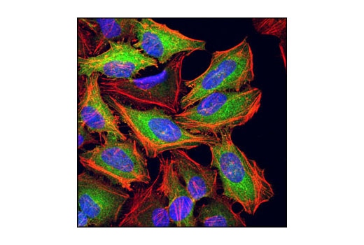 Confocal immunofluorescent analysis of HeLa cells using TGM2 (D11A6) XP ® Rabbit mAb (green). Actin filaments have been labeled with DY-554 phalloidin (red). Blue pseudocolor = DRAQ5 ® #4084 (fluorescent DNA dye).